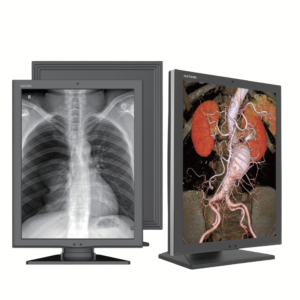 Alternative view of Màn hình chẩn đoán JUSHA 2MP, 21,3"